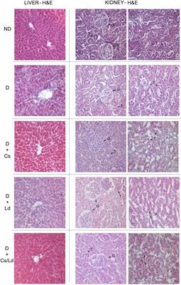 Evaluation of the Antioxidant and Antiglycation Effects of <mark class="highlighted">Lactarius</mark> deterrimus and Castanea sativa Extracts on Hepatorenal Injury in Streptozotocin-Induced Diabetic Rats